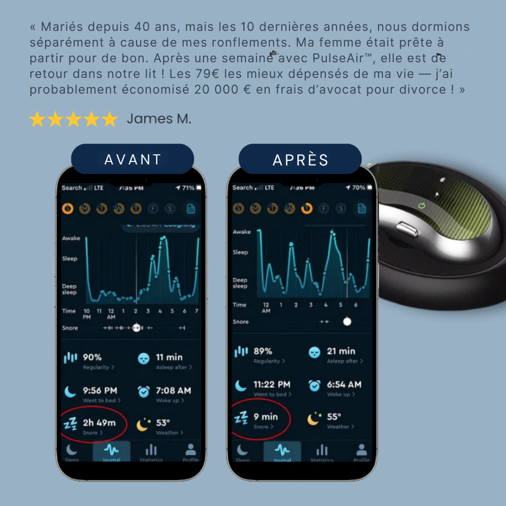 Neurovia PulseAir | Appareil Intelligent de Neurostimulation Anti-Ronflement